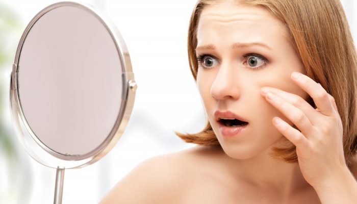 Дефекты кожи на лице у женщин