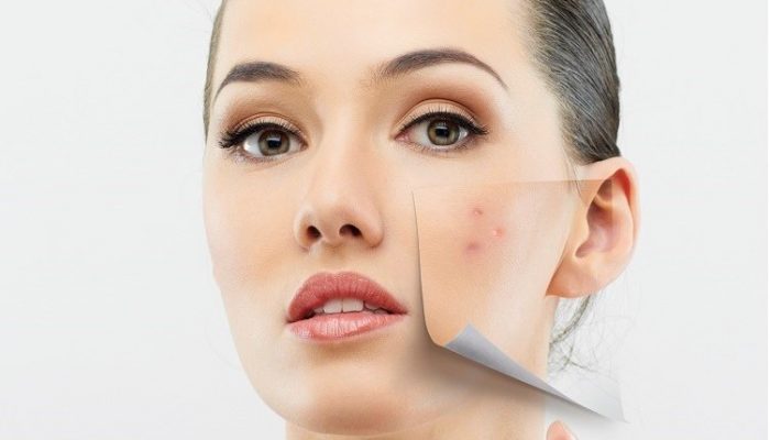 Виды дефектов кожи на лице